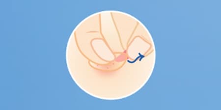 ÉTAPE 3 : Le patch devient blanc : il est temps de remplacer le patch contre l’acné
