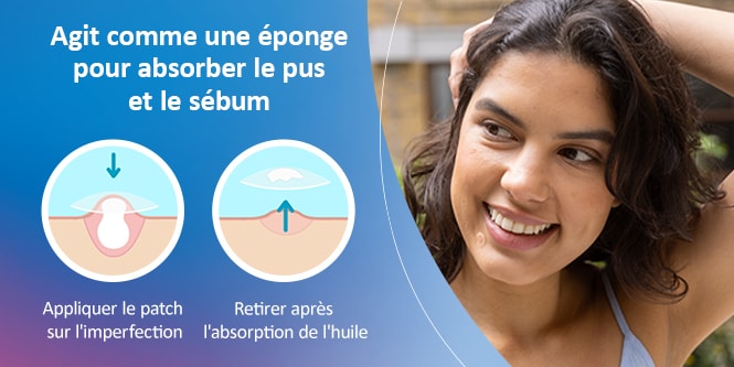 Schéma de l’action du patch anti-acné Nexcare™, qui absorbe le sébum des pores obstrués.
